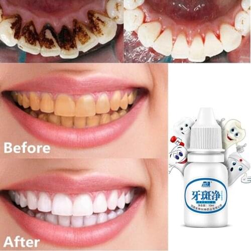 Teeth Whitening Water Liquid Oral Hygiene Cleaning 10 ML Effective Tooth Care