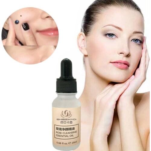 20ml Dark Spot Mole Repair Rose Essential Oil Skin Tag Freckle Painless Removal