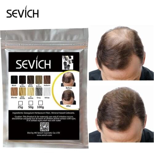 Sevich Hair Fibers Powder Original Refill Bag Keratin Fibers for Thin Hair Instant Wig Building Fibers Powders Hairline Comb 25g