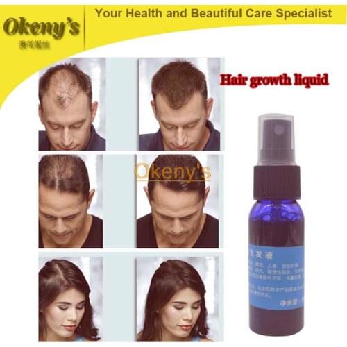 1pcs/lot Yuda Pilatory Stop Hair Loss Fast Hair Growth Products, Hair Growth Grow Restoration News Yuda 30ml