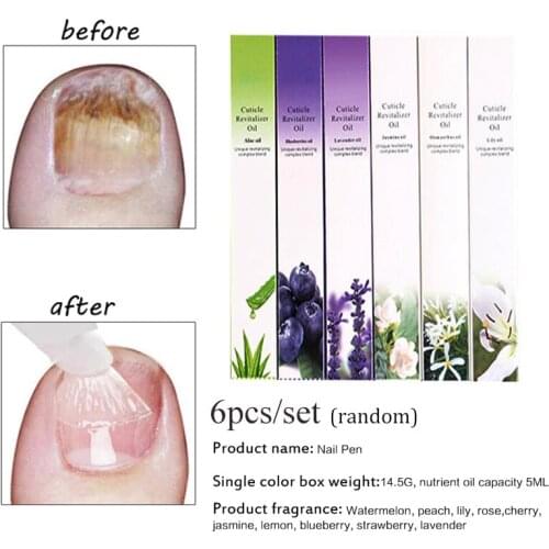 Nail Treatment Cuticle Revitalizer Nutrition Oil Pen Anti Cuticle Remover Nail Care Strengthening Repair Gel 6pc Do Dropshipping