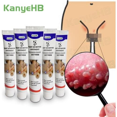 5pcs Genital Warts Remover Vulva Condyloma Ointment Penis Herpes Cream Private Parts Remove odor Antibacterial Ointment A637