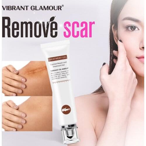 VIBRANT GLAMOUR Crocodile Scars Face Cream Dispel Scar Repair Gel Remove Acne Scar Stretch Marks Treatment Skin Lightening Care