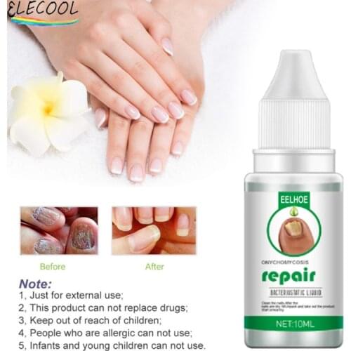 ELECOOL Nail Repair Serum Removal Gel Essences Fungal Care Treatments Foot Nail Fungus Anti-infective Paronychia Onychomycosis