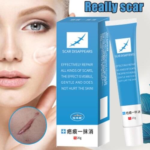Scar Removal Cream for Face Acne Scar Stretch Marks Remover Cream Skin Repair Cream 20g MH88