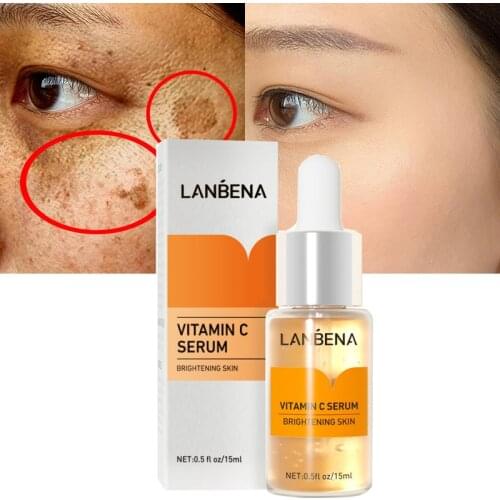 LANBENA Vitamin C Whitening Face Serum Fade Dark Spots Remove Freckle Brightening Facial Skin Essence Moisturizing Repair Care