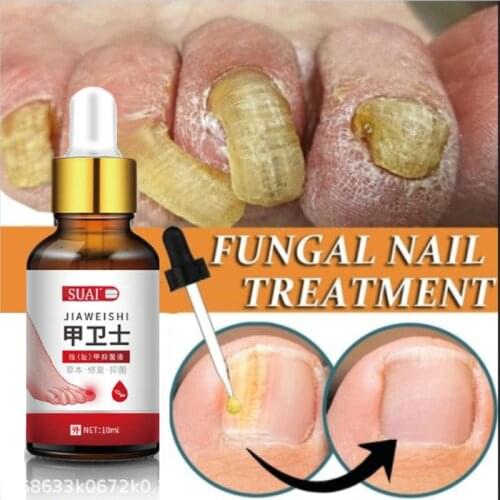 Fungal Nail Treatment Toe Nail Essence Nails Fungus Repair Serum Anti Infection Paronychia Onychomycosis Remover Foot Hand Care