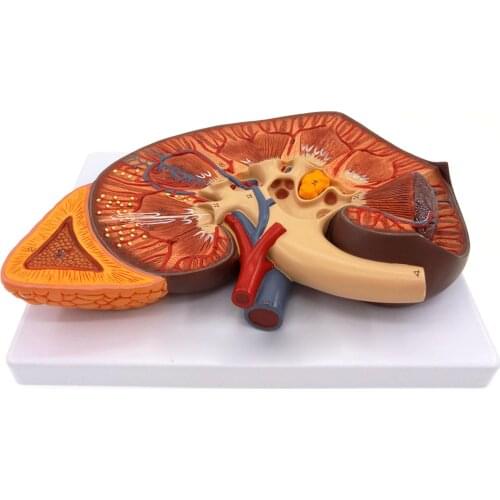 3 Times Enlarged Human Kidney Anatomical Medical Model With Adrenal Glands for Patient Education Teaching Resources