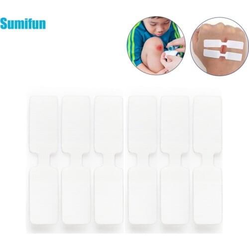 5/10/20pcs Adhesive Band Aid Stickers Painless Wound Closure Needles Suture-free Bandages Emergency Kit Adhesive Bandages C1975