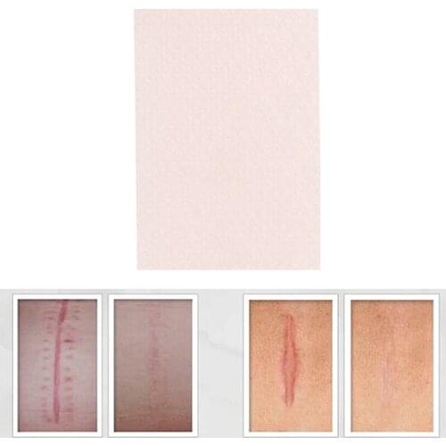 Silicone Gel Scar Sheet Removal Patch Reusable Acne Gel Scar Therapy Sheet Skin Repair 1pc Visible Scar Treatment 5cmx3.5cm