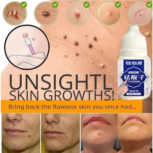 ZDAS Facial Cleansing Tools