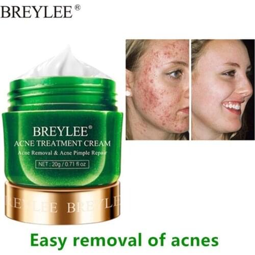 BREYLEE Acne Treatment Cream Anti Acne Face Cream Pimple Removal Spots Oil Control Shrink Pores Moisturizing Skin Care Serum 20g