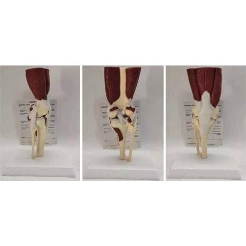 Human knee joint muscle model ligament structure meniscus bone skeleton medical teaching explanation model