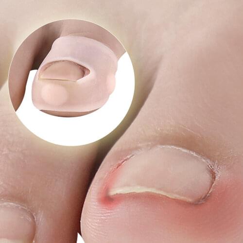 1Pair Ingrown Armor Elastic Patch Straightening Clip Brace Toenail Correction Tool Ingrown Toe Nail Treatment Pedicure Tool