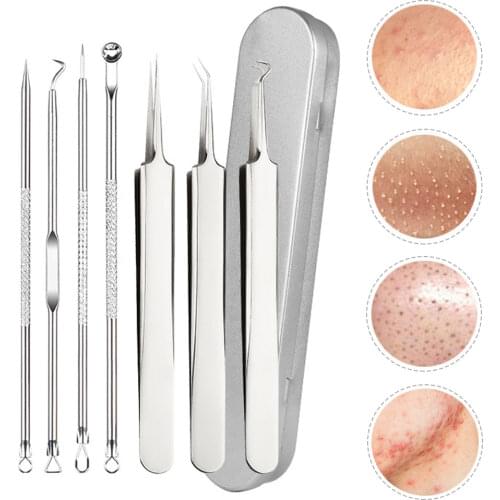 4PCS Acne Blackhead Comedone Black Spot Pimple Blemish Remover Skin Care Women Beauty Acne Treatment Pore Cleanser Needle Hook