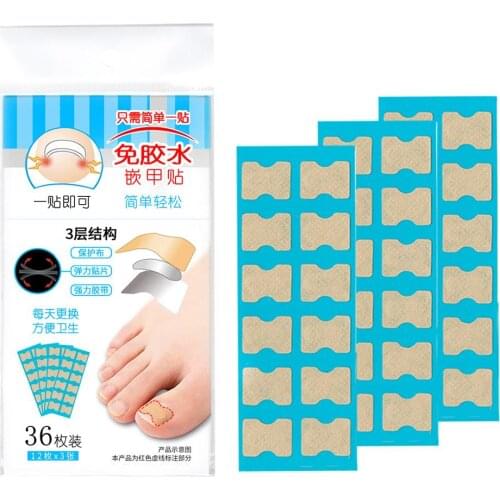 36/ 72Pcs Nail Correction Stickers New Recover Toe Ingrown Toe Nail Repair Paronychia Treatment No Glue Needed Foot Care Tools