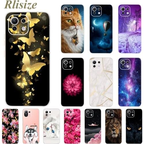 For Xiaomi Mi 11 Lite Case Soft Fundas Cute Patterned Cover For Xiaomi Mi11 Lite 11Lite Phone Cases Mi 11 Lite 5G Bumper 6.55