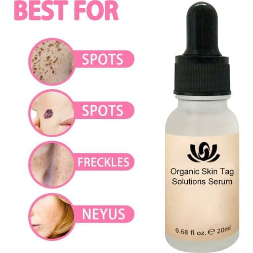 20ml Organic Mole Skin Tag Repair Solution Serum Skin Spot Removal Serum