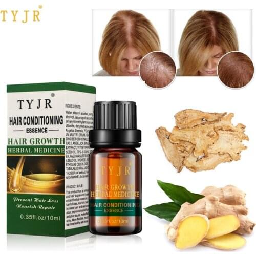 Hair Loss Care Natural Hair Growth Essential Oil Essence Hair Line Receding Hair Growth Liquid Serum