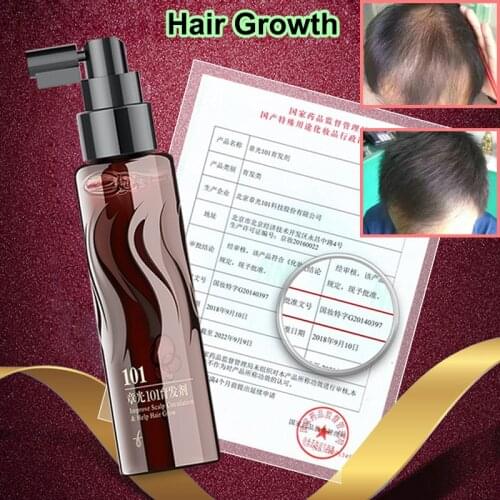 ZHANGGUANG 101 formula 120ml world Famous brand Chinese medicine therapy nourish the hair follicle hair regrowth for baldness