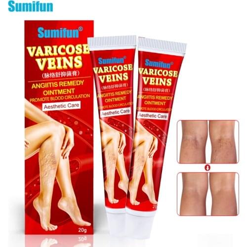 1Pcs 20g 100% Original Varicose Veins Treatment Cream Anti-swelling Red Capillary Vasculitis Pain Relief Ointment Skin Care