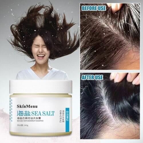 ROSALIND Sea Salt Anti-Dandruff Shampoo Cream Relieve Itching Control Oil Hair Shampoos Hair Care