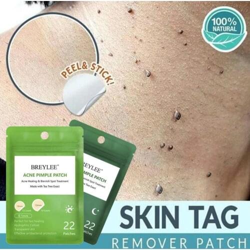 Acne Pimple Patch Invisible Acne Stickers Effectively Mask Tool Skin Acne Care Pimples Remove Blemish Removers Treatment T2R9