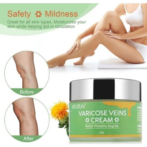 Varicose Veins Cream for Legs Relieves Varicose Vein Discomfort Pain Strain X7YB