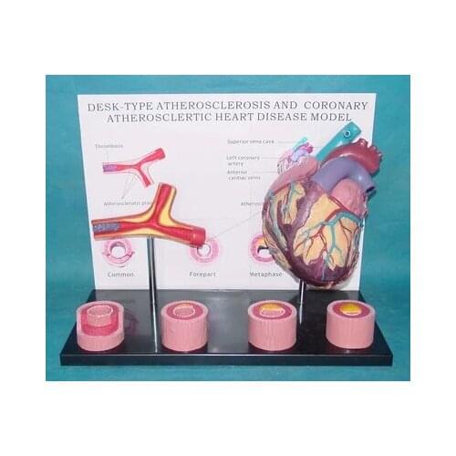 Artery model Heart anatomical model Medical teaching aids free shipping