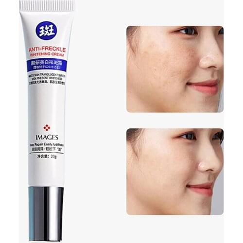 Effective Blemish Cream Pure Skin Anti Aging Cream Freckles Moisturzing Acne Pimple Scar Dark Spots Removal Skin Care Whitening