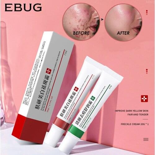 Effective Acne Removal Cream Acne Treatment Fade Acne Spots Oil Control Shrink Pores Whitening Moisturizing Acne Cream Skin Care