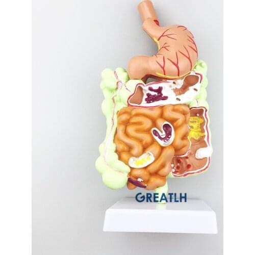 Human Digestive System Model Stomach Large Intestine Cecum Rectal Anatomy Model Teaching model