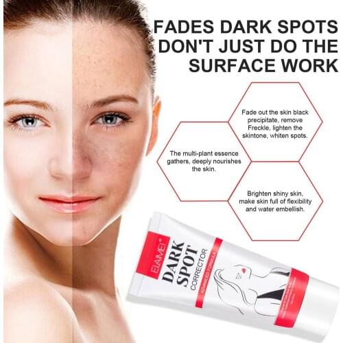 Effective Whitening Freckle Cream Remove Melasma Acne Spot Pigment Melanin Dark Spots Pigmentation Moisturizing Gel Skin Care
