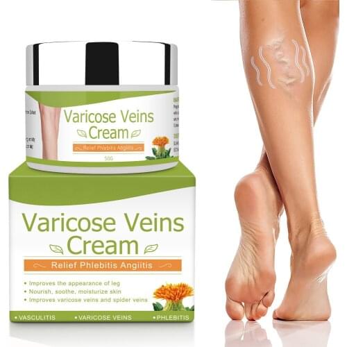 Varicose Veins Cream Natural Treatment Cream Chinese Herbal Remove Spider Veins For Legs Varicose Cream Tired Legs Fast Relief
