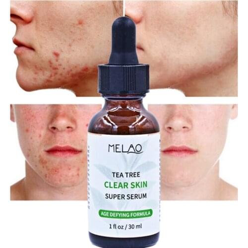 New Tea Tree Essential Oil Skin Care Moisturizing Oil-Control Smooth Scars Acne Remover Facial Care Product
