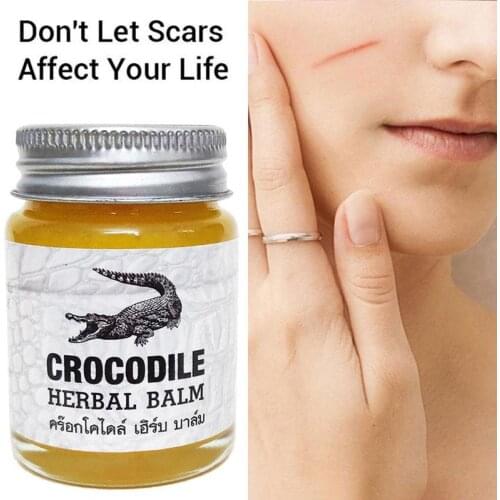 Crocodile Scar Removal Cream Thailand Herbal Balm Whitening Acne Marks Scar Face Corrector Remover Stretch Pigmentation Cre Q6C4