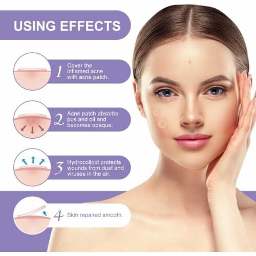 24pcs Acne Pimple Patch Stickers Acne Pimple Remover Tool Skin Tag Remover Waterproof Pimple Master Patch Treatments Invisible