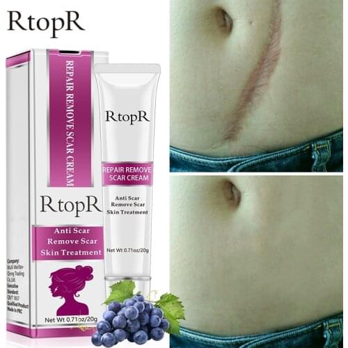 RtopR Acne Scar Stretch Marks Remover Cream Skin Repair Face Cream Acne Spots Acne Treatment Blackhead Whitening Cream Skin Care