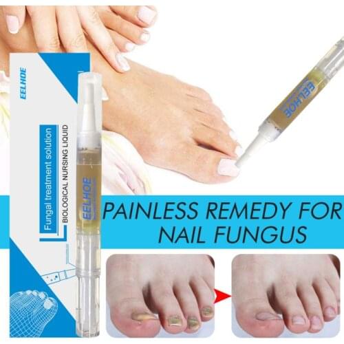 3ML Fungal Nail Treatment Pen With Brush Onychomycosis Paronychia Anti Fungal Nail Effective TreatmentChinese Herbal TSLM1