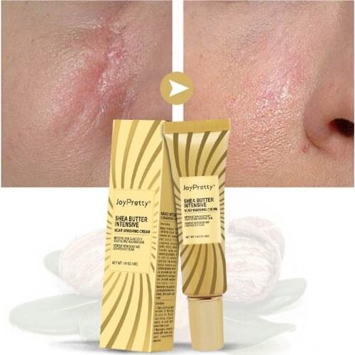 40g Acne Scar Removal Cream Pimples Stretch Marks Face Gel Remove Acne Smoothing Whitening Moisturizing Body Skin Care