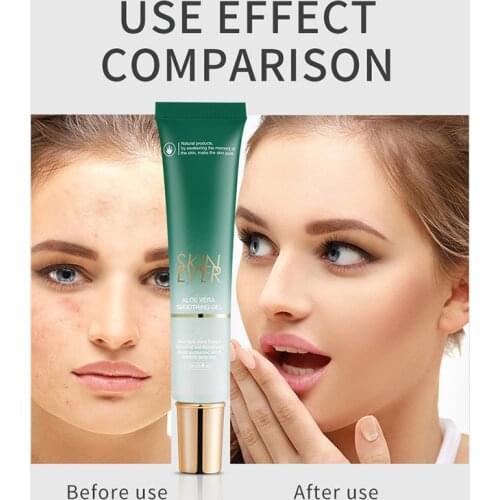 Aloe Vera Gel Soothing Moisturizer Lotion Sunburn Relief Hydrating Soften Match Any Skin Stypes Aloe Vera Gel For Face Hydrating