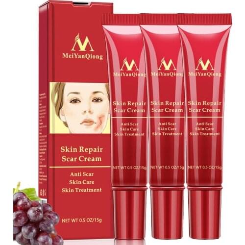 Scar Removal Cream Acne Scars Gel Repair Stretch Marks Remove Surgical Scar Burn Body Pigmentation Corrector Scar Skin Care 3pcs