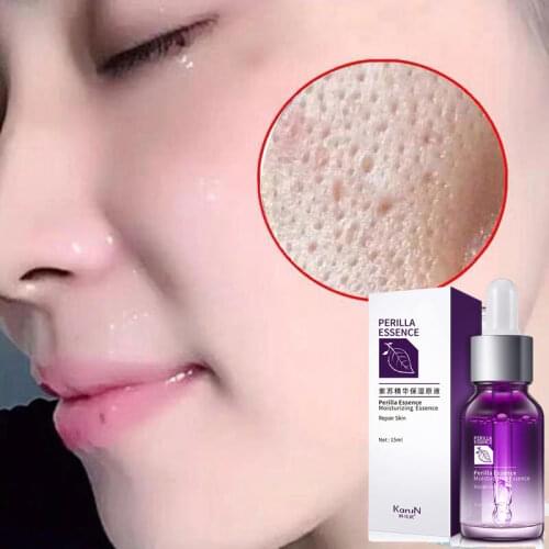 Perilla face serum hyaluronic acid serum facial skin care whitening shrink pores essence oil control anti aging acne wrinkle