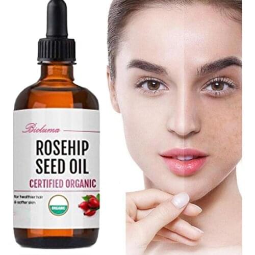 10ml/30ml Organic Rosehip Seed Oil for Face-pure Cold Pressed Oil Natural Non-greasy Deeply Moisturize Moisturizing Serum