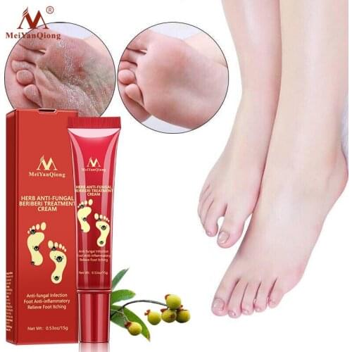 Foot Care Cream Foot spa Pedicure Herbal Detox Anti Fungal Infection Onychomycosis Fungus Treatment For legs
