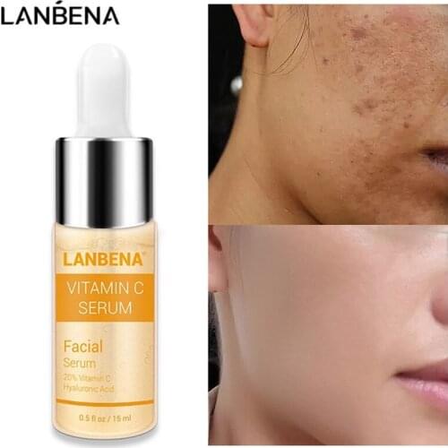 Vitamin C Whitening Face Serum Care Lighten Spots Brightening Facial Skin Essence Fade Dark Spots Remove Freckle Speckle Product