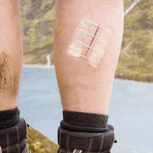 1pc Zipper Painless Wound Closure Device Without Needles Zip Patch Suture-free Dressing Suture Reducer Portable Wound Outdo O8G7