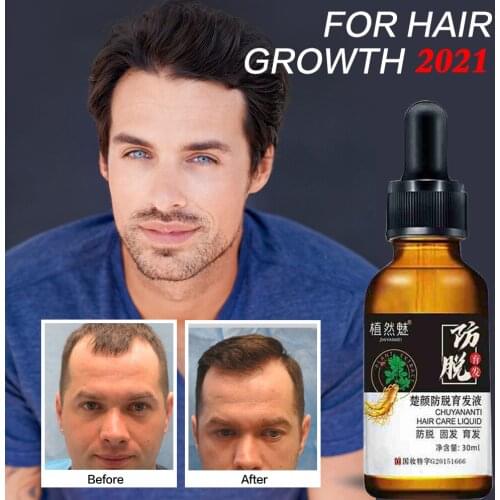 New Hair Loss Products and Fast Hair Growth Remedy Essence Oil Natural Extracts Liquid Hair Regrowth Products Treatment Solution