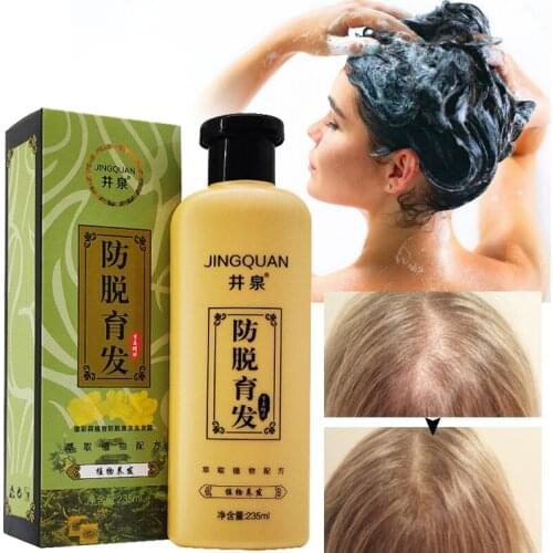 Yoxier Hair Oils