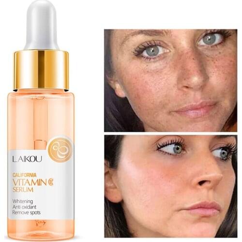 Vintamin C Serum Antioxidant Brighten Skin Face Essence Ascorbic Acid Reduce Spots Even Skin Tone Whitening Skin Care Liquid
